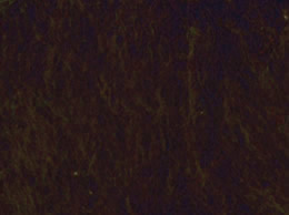 7 - DARK BROWN
